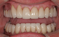 Closeup of healthy white smile