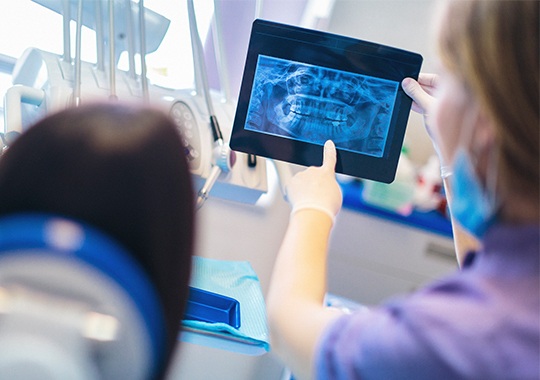 Digital dental x-rays