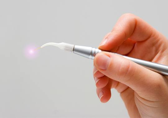 Laser dentistry wand