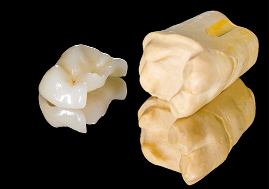 Model tooth with dental restoration