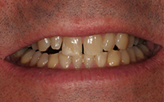 Yellow and irregularly sized teeth