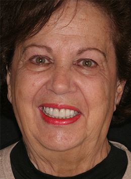 Older woman with healthy teeth and gums