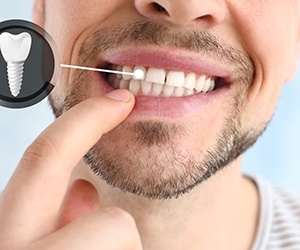 A man pointing out his newly implanted tooth