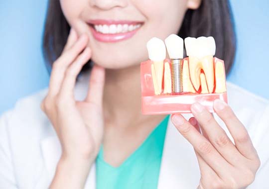 dentist holding a dental implant model