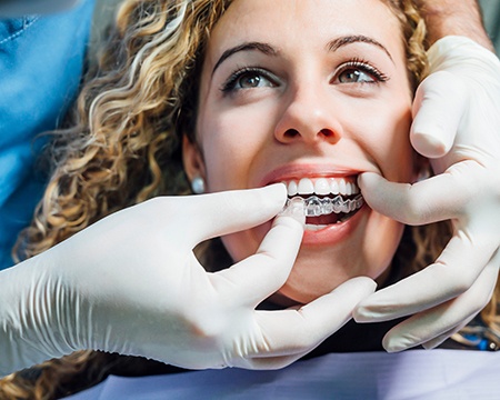 Woman smiling while dentist places clear aligner