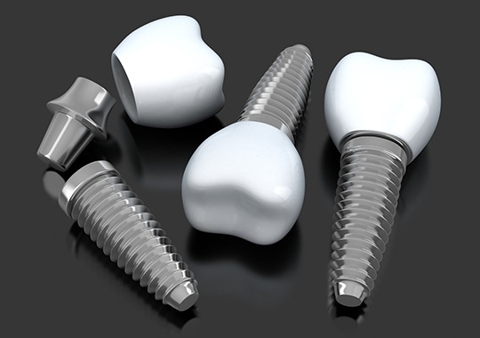 Animated implant supported dental crowns