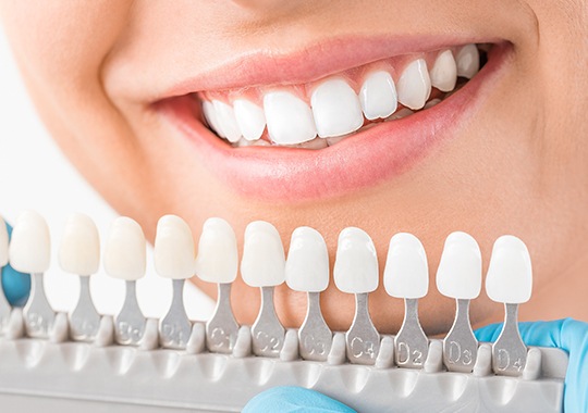 Closeup of teeth compared to tooth color chart