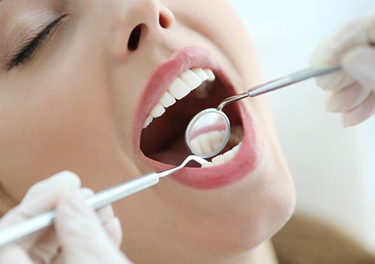 Closeup of smile during dental exam