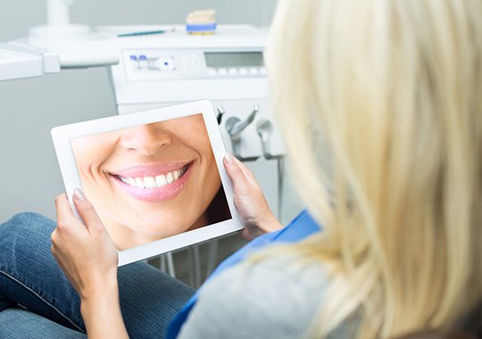 Woman looking at her smile design on computer