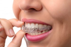 woman putting invisalign tray on teeth