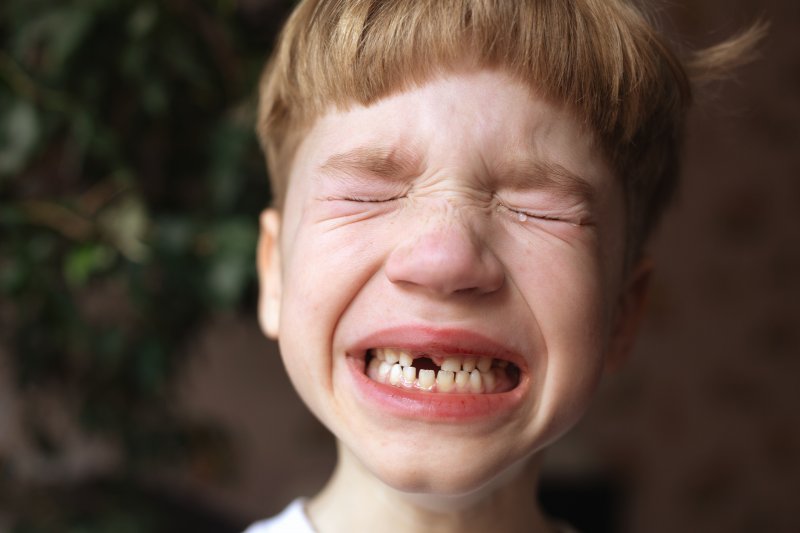 A young boy with a knocked-out tooth