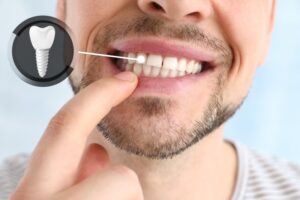 Man checking the condition of his dental implant